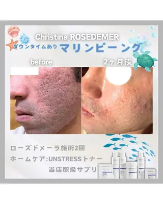 メンズ Beauty Salon　Meilily所属・肌質改善サロン Meilily🦋のエステ・リラクイメージ