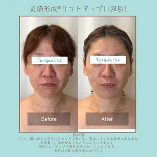 フェイシャルエステ Turquoiseのエステ・リラクイメージ