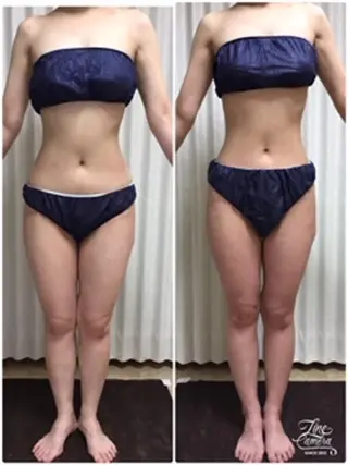 レイビス盛岡店 ♡吉田♡のエステ・リラクイメージ