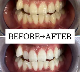 【歯科提携】歯のセルフホワイトニング専門店 セルフホワイトニングサロン宝塚所属・箕浦 乙葉のその他イメージ