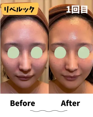 コンセプトサロン〜友〜所属・コンセプトサロン友 木下のエステ・リラクイメージ