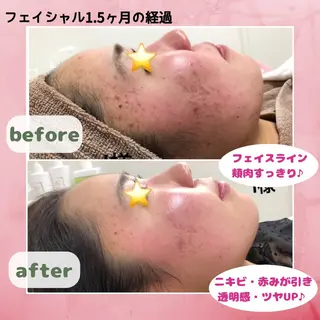 Prima栄店所属・Prima 〜プリマ栄店〜のエステ・リラクイメージ