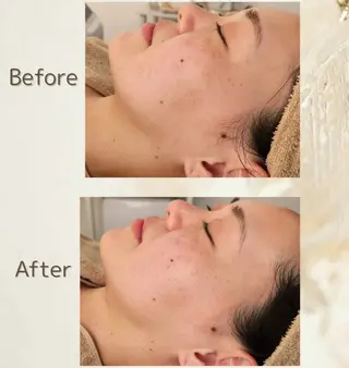 シェービングサロン ＆W/アンダブルのエステ・リラクイメージ