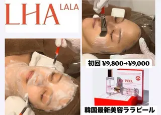 White Calm 天王寺所属・ハーブピーリング White Calmのその他イメージ