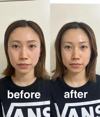 美容鍼灸サロン mahoroba院長のエステ・リラクイメージ