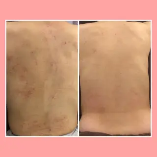 ショート カラー パーマ ヘアアレンジ メンズ キッズ ネイル マツエク・マツパ ニキビ・肌質改善専門 ♡人生が変わるサロンのエステ・リラクイメージ