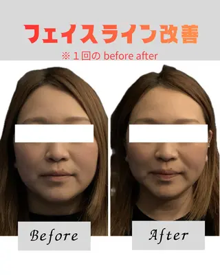 Re mのエステ・リラクイメージ