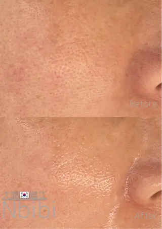 韓国🇰🇷価格 サロン_Nbibiのエステ・リラクイメージ