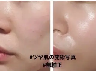 amor Beautyのマツエク・マツパデザイン