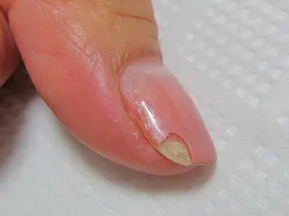 ネイル ネイルサロン HARRYS所属・ネイル･脱毛サロン HARRYSのエステ・リラクイメージ