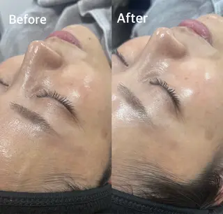 라라피（ララピ）所属・韓国式肌管理 ララピール専門のエステ・リラクイメージ