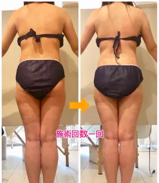 ショート カラー パーマ ヘアアレンジ メンズ キッズ ネイル マツエク・マツパ ‍痩身＆ボディ 結果出し🌟丹野のエステ・リラクイメージ