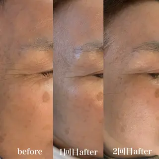 フィユ所属・〚博多〛フィユ 水江のマツエク・マツパデザイン