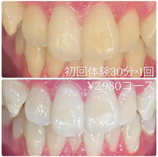 PLATINUM Beauty 横浜店所属・ホワイトニングルーム 横浜店のその他イメージ