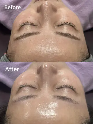 小顔専門看護師クリニカルサロンCOCO所属・小顔と美肌サロン クリニカルサロンココのエステ・リラクイメージ