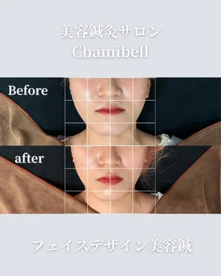 美容鍼灸サロン Chamibelleのエステ・リラクイメージ