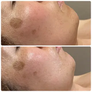 【美乳♡美肌専門サロン】Fleur所属・Fleur 神藤のエステ・リラクイメージ