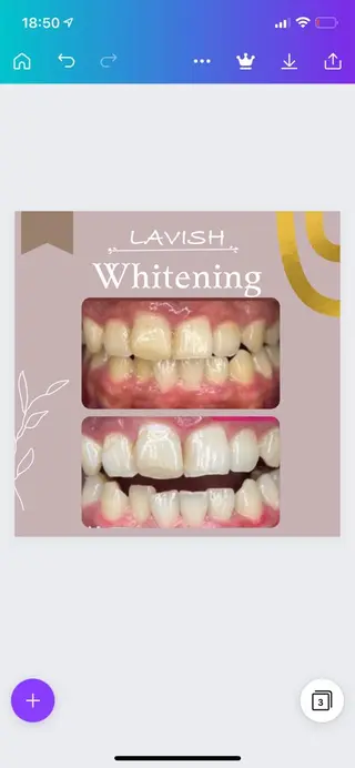 LAVISH nail salonのネイルデザイン