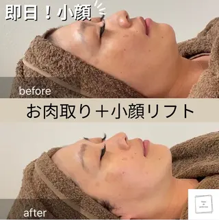 salon de perfectionのエステ・リラクイメージ