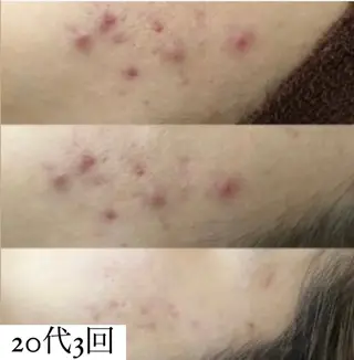 AtelierRin小牧本店所属・AtelierRin Ayumiのマツエク・マツパデザイン