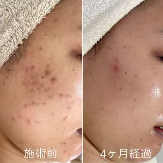 シェノン所属・ニキビ・毛穴・ フェイシャル専門店のその他イメージ