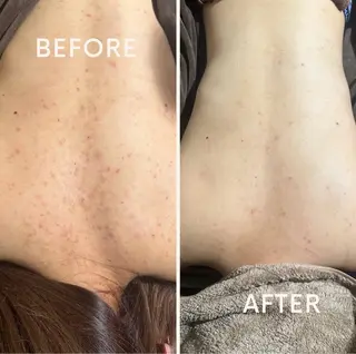 エミルカ 自由が丘店所属・花島 悠のエステ・リラクイメージ