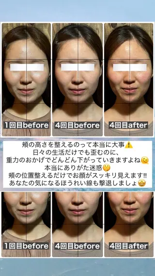 💎後悔させない小顔 矯正💎イトヤマ🌱のエステ・リラクイメージ