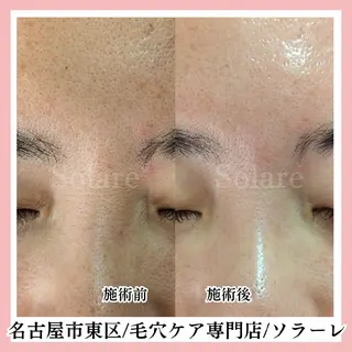  毛穴洗浄・まつ毛 の専門店 ソラーレのエステ・リラクイメージ