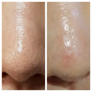 calla lily所属・Calla lily 🫧のエステ・リラクイメージ