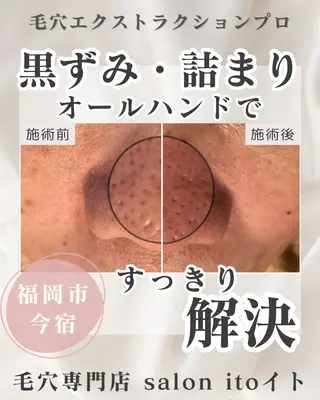 伊藤 みかのエステ・リラクイメージ