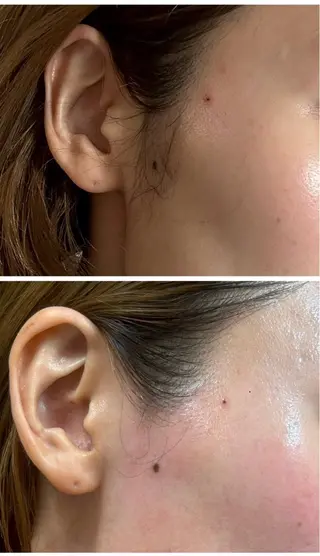 艶肌/角質ケア フェイシャルワックスのエステ・リラクイメージ