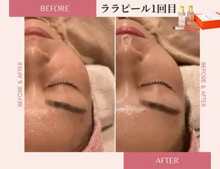 医療提携サロン&パーソナルカラー/骨格/顔タイプ診断 La chic所属・パーソナルカラー &エステ SHIHOのその他イメージ