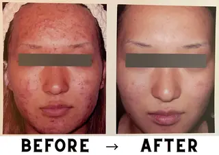 VICTOIRE MARUYAMAのエステ・リラクイメージ