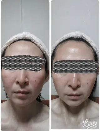 Anabel所属・東 利恵のエステ・リラクイメージ