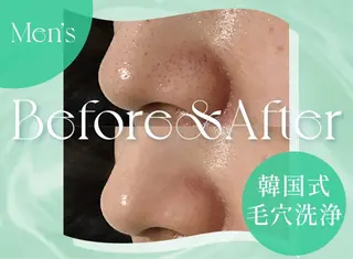 韓国肌管理専門店 Clear Lab 池袋所属・韓国肌管理専門店 池袋店REIKAのエステ・リラクイメージ