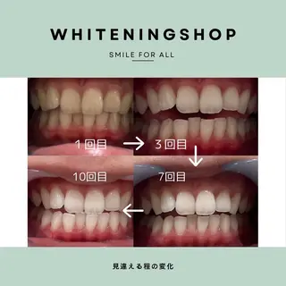 ホワイトニングショップ鳥栖店所属・ホワイトニング ショップ 鳥栖店のその他イメージ