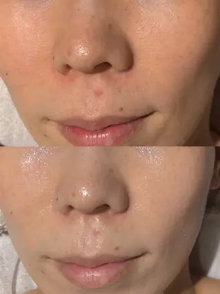 /ulu  soin所属・太田 玲奈のエステ・リラクイメージ