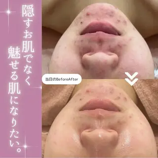 【現役看護師】高来 笑子のエステ・リラクイメージ