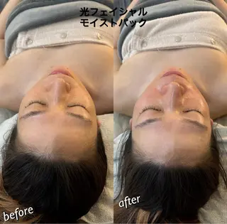 うなじ脱毛/美肌脱毛 LABELのエステ・リラクイメージ