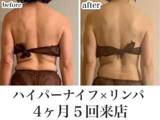 REME/リミー エステサロン東大宮店所属・小林 雪乃のエステ・リラクイメージ