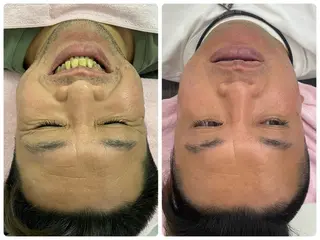 Salon Rion所属・Rion 野々村のエステ・リラクイメージ