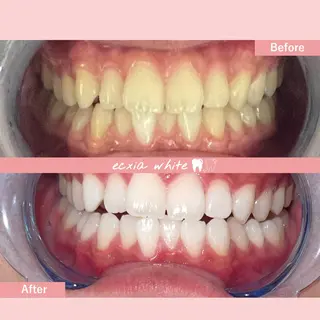 セルフホワイトニング エクシア中島公園店のその他イメージ