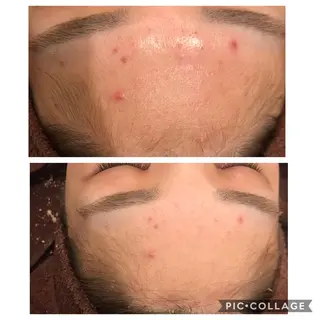 セミロング カラー パーマ ヘアアレンジ メンズ キッズ ネイル マツエク・マツパ 四つ星サロン🎖 腸＆ニキビケアに特化のエステ・リラクイメージ