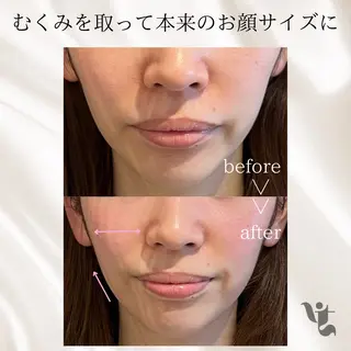 【vidyto】ヴィディトゥ所属・肌管理サロン vidyto　MOEのエステ・リラクイメージ