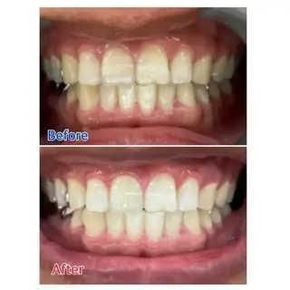 M渋谷店所属・M渋谷 ホワイトニングのエステ・リラクイメージ