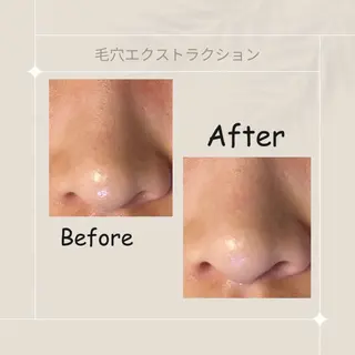 ピーリング専門店 Belluteのエステ・リラクイメージ