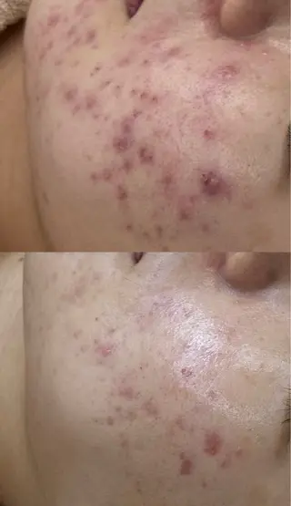 MAILE-マイレ-BEAUTY SALON所属・MAILE-マイレ- NARUMIのエステ・リラクイメージ