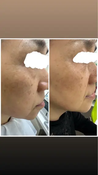 デ・アイム塚口所属・肌質/体質改善 久下玲菜のエステ・リラクイメージ