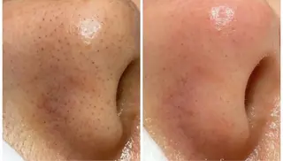 ルーチェサロン所属・中野 睦美のエステ・リラクイメージ