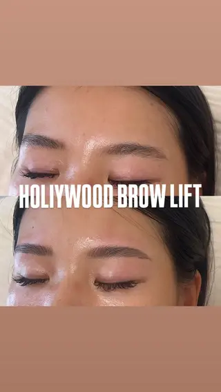 アイブロウ BELLIS HUIT所属・ハーブピーリング那覇 BELLISHUITのエステ・リラクイメージ